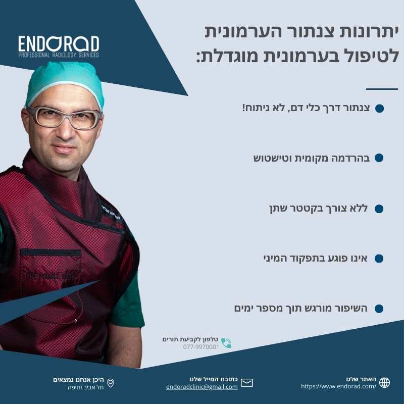 אינפוגרפיקה המציגה את היתרונות העיקריים של צנתור הערמונית לטיפול בערמונית מוגדלת: ללא ניתוח, ללא צורך בקטטר שתן, אינו פוגע בתפקוד המיני, והקלה תוך מספר ימים בלבד.